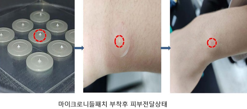 6 1. G9 바이오 2