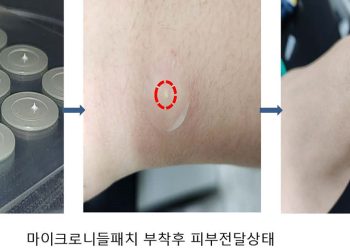 G9BIO-베일러의대, 마이크로니들 플랫폼 공동연구·개발 추진