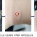 G9BIO-베일러의대, 마이크로니들 플랫폼 공동연구·개발 추진 7 G9BIO-베일러의대, 마이크로니들 플랫폼 공동연구·개발 추진