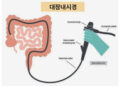 대장내시경 후 우버 이용 불가 이유