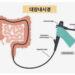 대장내시경 후 우버 이용 불가 이유