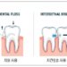 "치실·치간칫솔 쓰니 뇌졸중 위험 23% 낮아졌다" 6 “치실·치간칫솔 쓰니 뇌졸중 위험 23% 낮아졌다”