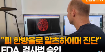 [영상]”피 한방울로 알츠하이머 진단”…FDA, 검사법 승인
